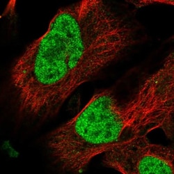 BP1 Antibody, Novus Biologicals:Antibodies:Primary Antibodies